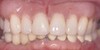 Upper and lower arch rehabilitation treatment view