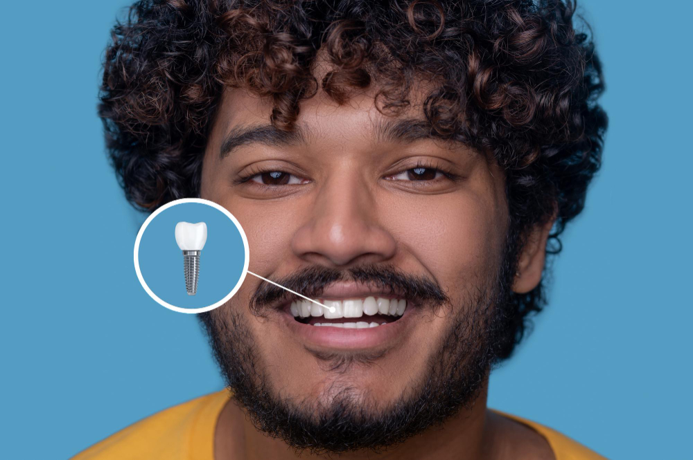 Implant Restoration  Soquel, CA