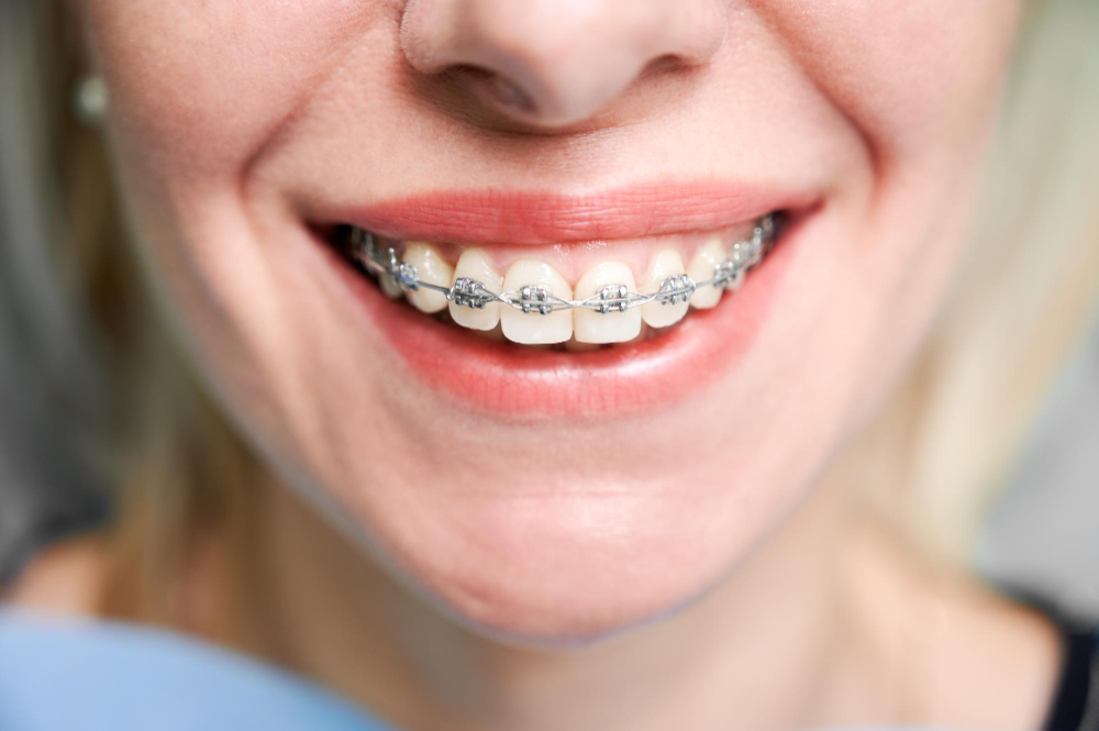 orthodontic services  Soquel, CA