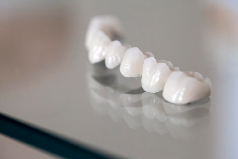 Porcelain Crowns in Soquel